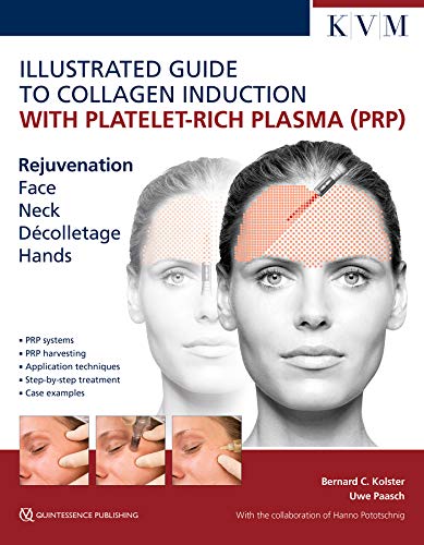 9781786980298: Illustrated Guide to Collagen Induction with Platelet-Rich Plasma (PRP): Rejuvenation Face | Neck | Decollete | Hands