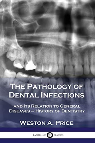 Beispielbild fr The Pathology of Dental Infections: and Its Relation to General Diseases - History of Dentistry zum Verkauf von Book Deals