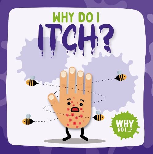 Beispielbild fr Itch (Why Do I?) zum Verkauf von WorldofBooks
