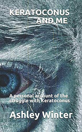 Stock image for KERATOCONUS AND ME: A personal account of the struggle with Keratoconus for sale by WorldofBooks