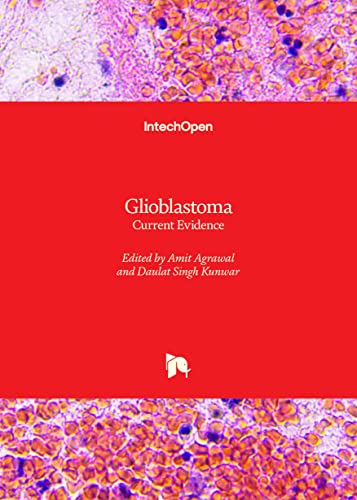 Stock image for Glioblastoma - Current Evidence for sale by GreatBookPrices