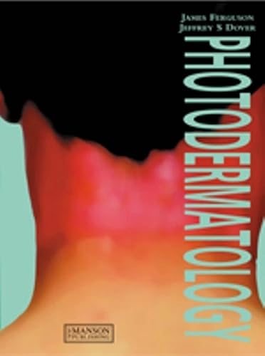 Stock image for Photodermatology for sale by Last Exit Books