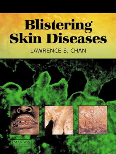 9781840760668: Blistering Skin Diseases