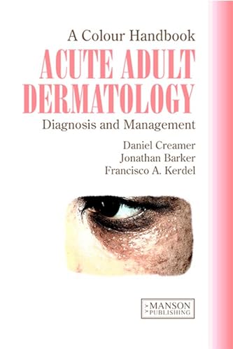 Beispielbild fr Acute Adult Dermatology: Diagnosis and Management: A Colour Handbook (Medical Color Handbook Series) zum Verkauf von Reuseabook