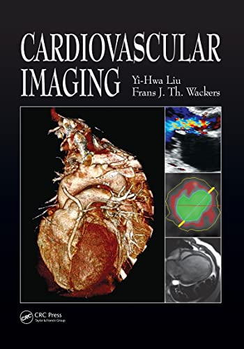 9781840761092: Cardiovascular Imaging