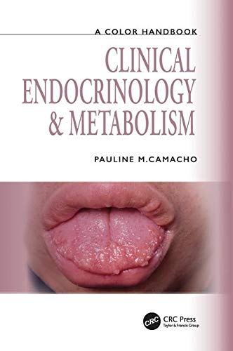 Clinical Endocrinology and Metabolism (Medical Color Handbook Series) (2011) (PDF) Pauline M. Camacho