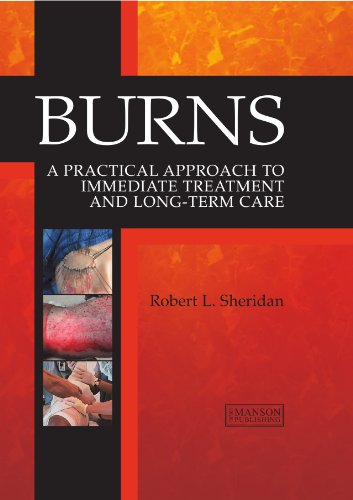 Stock image for Burns : A Practical Approach to Immediate Treatment and Long Term Care for sale by Better World Books Ltd