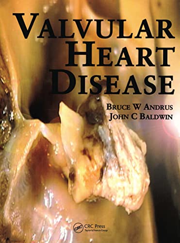 Stock image for Valvular Heart Disease for sale by Anybook.com
