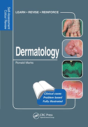 Beispielbild fr Dermatology zum Verkauf von Blackwell's