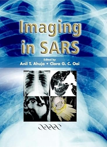 Stock image for Imaging in Sars (Hardcover) for sale by CitiRetail