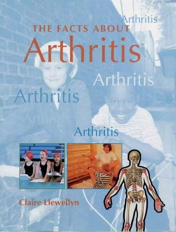 Beispielbild fr FACTS ABOUT ARTHRITIS zum Verkauf von WorldofBooks