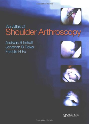 9781841840017: Atlas of Shoulder Arthroscopy