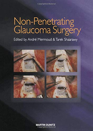 Imagen de archivo de Non-Penetrating Glaucoma Surgery a la venta por Books Puddle