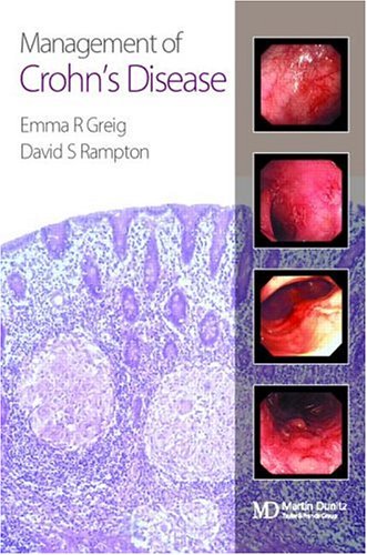 Management Of Crohn'S Disease - Greig, Emma; Rampton, David