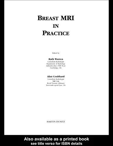 Stock image for Breast MRI in Practice for sale by Chiron Media