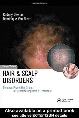 9781841841939: Hair and Scalp Disorders: Common Presenting Signs, Differential Diagnosis