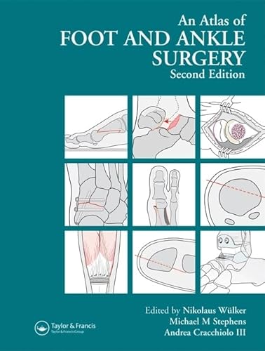 Beispielbild fr Atlas Foot and Ankle Surgery, Second Edition zum Verkauf von Chiron Media