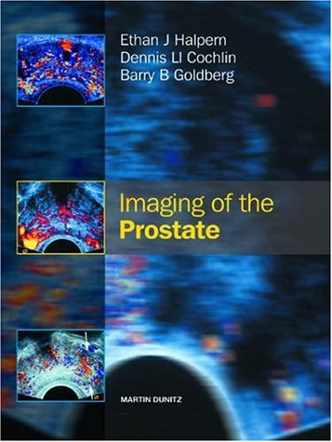 Imagen de archivo de Imaging of the Prostate a la venta por Better World Books