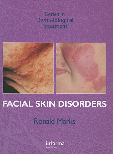 9781841842103: Facial Skin Disorders (Series in Dermatological Treatment)