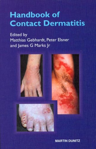 Stock image for Handbook of Contact Dermatitis for sale by Phatpocket Limited