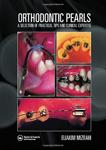 Orthodontic Pearls: A Selection of Practical Tips & Clinical Expertise
