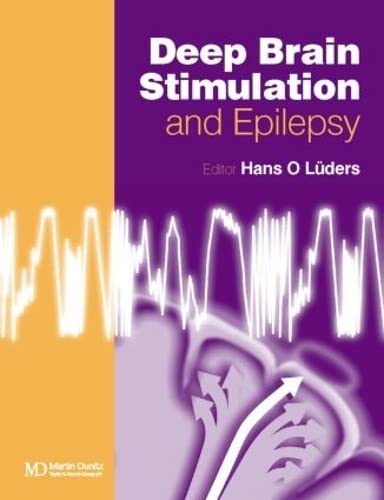 Deep Brain Stimulation and Epilepsy (9781841842592) by LÃ¼ders, Hans O.