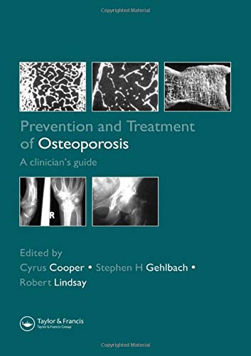 Imagen de archivo de Prevention and Treatment of Osteoporosis: A Clinician's Guide a la venta por Daedalus Books