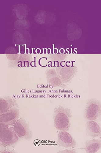 Stock image for Thrombosis and Cancer for sale by The Oregon Room - Well described books!
