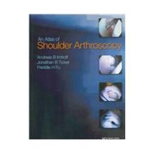 9781841843377: Atlas of Shoulder Arthroscopy