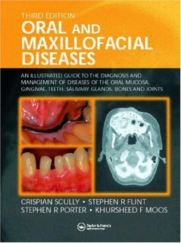 Stock image for Oral and Maxillofacial Diseases: An Illustrated Guide to Diagnosis and Management of Diseases of the Oral Mucosa, Gingivae, Teeth, Salivary Glands, Bones, and Joints for sale by Phatpocket Limited