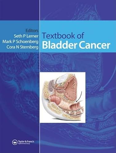 Stock image for Textbook of Bladder Cancer for sale by GF Books, Inc.