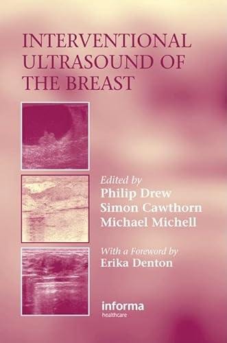 Imagen de archivo de Interventional Ultrasound of the Breast a la venta por Revaluation Books