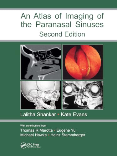 Beispielbild fr Atlas of Imaging of the Paranasal Sinuses, Second Edition zum Verkauf von Revaluation Books