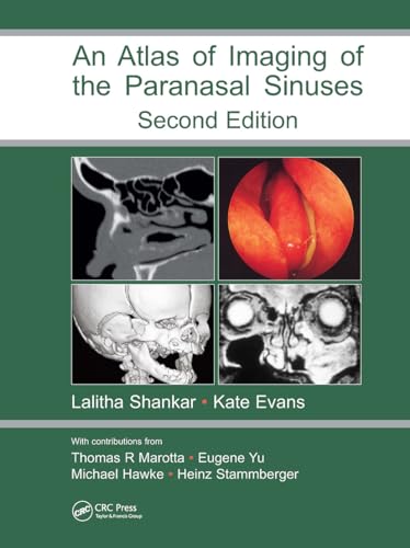 9781841844480: An Atlas of Imaging of the Paranasal Sinuses, Second Edition