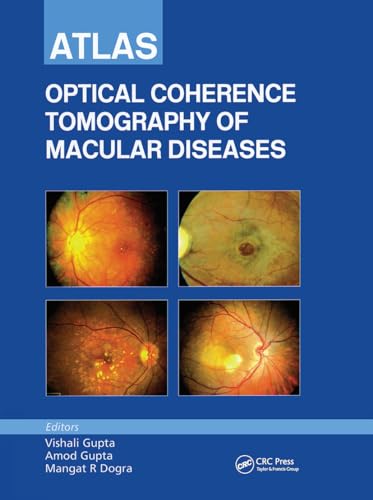 Beispielbild fr Atlas of Optical Coherence Tomography of Macular Diseases zum Verkauf von medimops