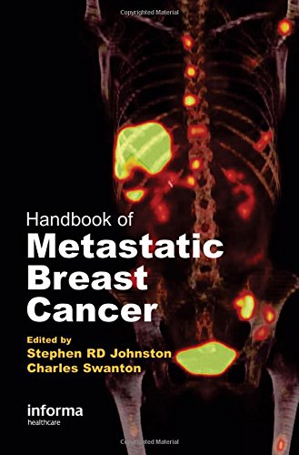 Imagen de archivo de Handbook of Metastatic Breast Cancer a la venta por BookHolders