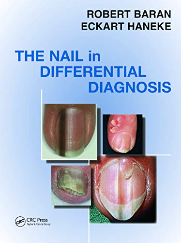 Stock image for Nail in Differential Diagnosis for sale by Books Puddle