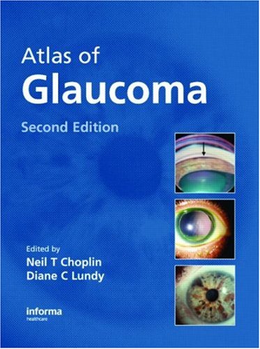 9781841845180: Atlas of Glaucoma, Second Edition