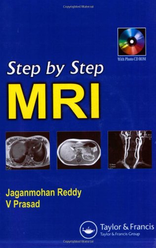 Stock image for Step by Step MRI for sale by ThriftBooks-Atlanta