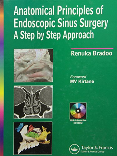 9781841845388: Anatomical Principles of Endoscopic Sinus Surgery: A Step by Step Approach