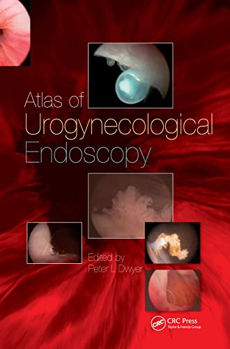 Stock image for Handbook of Urologic Cryoablation for sale by Books Puddle