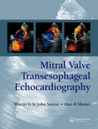 Imagen de archivo de Mitral Valve Transesophageal Echocardiography a la venta por Chiron Media