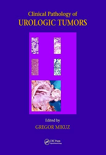 Stock image for Clinical Pathology of Urological Tumours for sale by Books Puddle