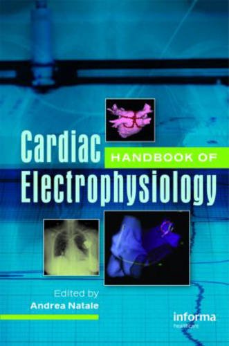 Stock image for Handbook of Cardiac Electrophysiology for sale by HPB-Red