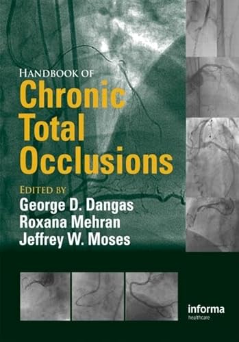 Imagen de archivo de Handbook of Chronic Total Occlusions a la venta por The Warm Springs Book Company