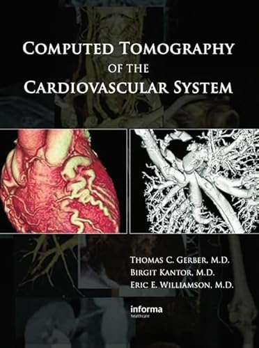 Stock image for Computed Tomography of the Cardiovascular System for sale by Chiron Media