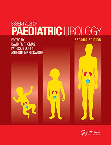 Stock image for Essentials of Paediatric Urology for sale by ThriftBooks-Dallas