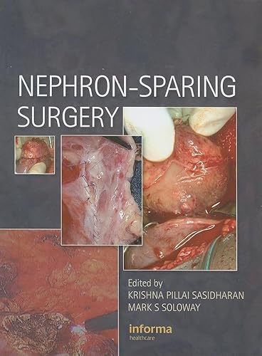 9781841846361: Nephron-Sparing Surgery