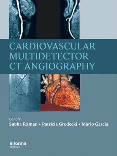 Imagen de archivo de Cardiovascular Multidetector CT Angiography a la venta por Better World Books: West