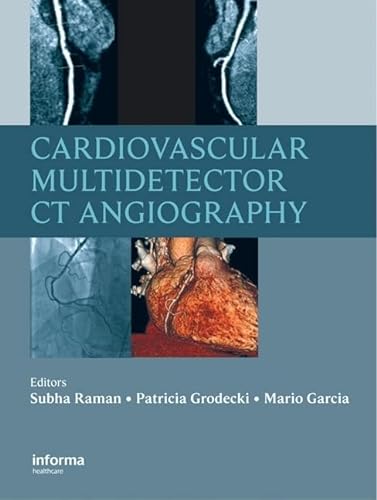 Stock image for Cardiovascular Multidetector CT Angiography for sale by Better World Books: West